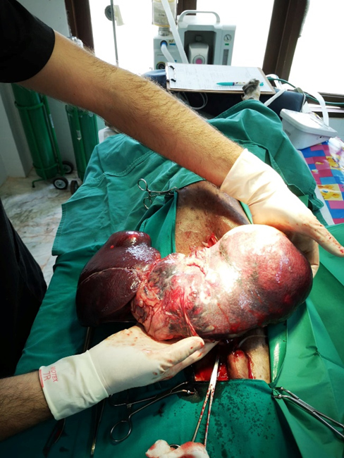 Long: histiocytoma and splenomegaly