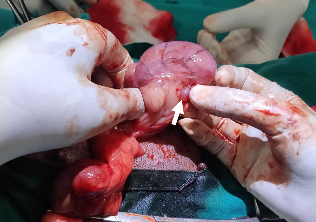 Ovariohysterectomy versus Ovariectomy - which technique should I use?